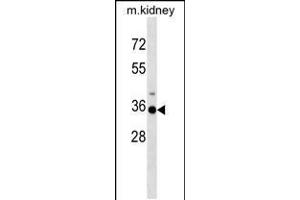 Western blot analysis in mouse kidney tissue lysates (35ug/lane). (HOXA3 anticorps  (C-Term))