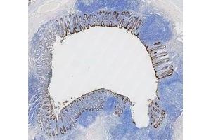 IHC analysis of Cytokeratin 8/KRT8 using anti-Cytokeratin 8/KRT8 antibody (ABIN5518853).