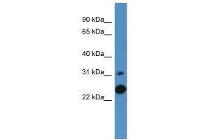 Western Blotting (WB) image for anti-Carbonic Anhydrase VII (CA7) (C-Term) antibody (ABIN2788332)