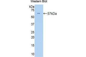 Western blot analysis of the recombinant protein. (COL3A1 anticorps  (AA 1059-1466))