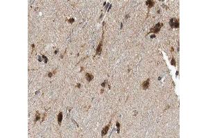 ABIN6266901 at 1/100 staining human brain tissue sections by IHC-P. (FHIT anticorps  (Internal Region))