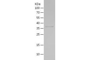 Western Blotting (WB) image for Integrin alpha FG-GAP Repeat Containing 1 (ITFG1) (AA 250-346) protein (His-IF2DI Tag) (ABIN7123467)