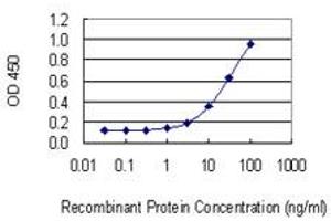 Detection limit for recombinant GST tagged MAST2 is 0.