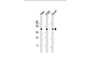 All lanes : Anti-PLIN3 Antibody at 1:2000 dilution Lane 1: Hela whole cell lysate Lane 2: K562 whole cell lysate Lane 3: Daudi whole cell lysate Lysates/proteins at 20 μg per lane. (PLIN3 anticorps  (AA 1-434))