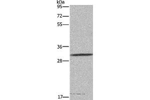 Western blot analysis of 231 cell, using ASGR1 Polyclonal Antibody at dilution of 1:300 (Asialoglycoprotein Receptor 1 anticorps)