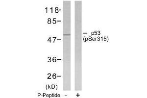 Image no. 1 for anti-Tumor Protein P53 (TP53) (pSer315) antibody (ABIN196788) (p53 anticorps  (pSer315))