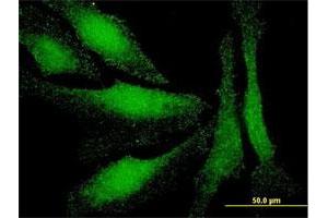 Immunofluorescence of monoclonal antibody to LMO3 on HeLa cell. (LMO3 anticorps  (AA 91-146))