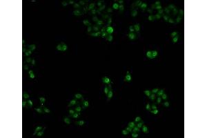 Immunofluorescence staining of Hela cells with ABIN7150422 at 1:100, counter-stained with DAPI.