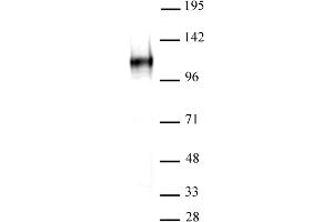 BCL11A antibody (mAb) tested by Western blot. (BCL11A anticorps  (AA 637-835))