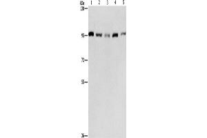 Western Blotting (WB) image for anti-Minichromosome Maintenance Complex Component 5 (MCM5) antibody (ABIN2421835) (MCM5 anticorps)