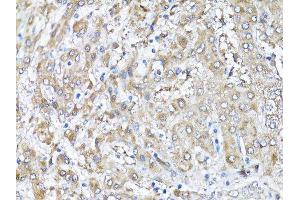 Immunohistochemistry of paraffin-embedded human liver using SNAI1 antibody.
