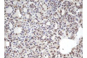 Image no. 1 for anti-Chromobox Homolog 8 (CBX8) (AA 1-260) antibody (ABIN1490659)