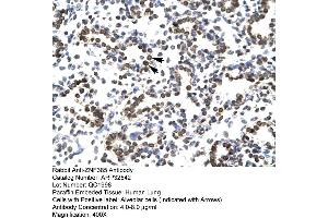 anti-Zinc Finger Protein 385A (ZNF385A) (N-Term) antibody