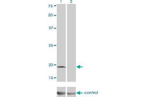 Image no. 2 for anti-DCMP Deaminase (DCTD) (AA 69-179) antibody (ABIN466000) (DCMP Deaminase (DCTD) (AA 69-179) anticorps)