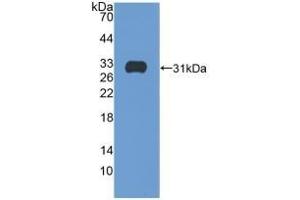 Detection of Recombinant ITGb5, Human using Polyclonal Antibody to Integrin Beta 5 (ITGb5) (Integrin beta 5 anticorps  (AA 137-378))