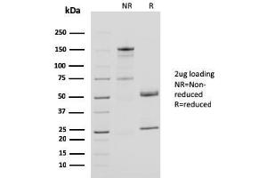 SDS-PAGE Analysis Purified CD40L Mouse Monoclonal Antibody (CD40LG/2761). (CD40 Ligand anticorps  (AA 108-261))