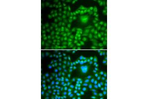 Immunofluorescence analysis of U2OS cells using PP1 beta antibody . (PPP1CB anticorps  (AA 1-327))