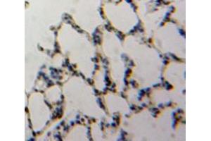 Used in DAB staining on fromalin fixed paraffin-embedded Lung tissue (TBX4 anticorps  (AA 284-545))