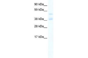 WB Suggested Anti-ZNF17 Antibody Titration:  0. (ZNF17 anticorps  (N-Term))