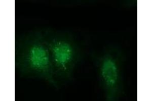 anti-RAB, Member of RAS Oncogene Family-Like 2A (RABL2A) antibody