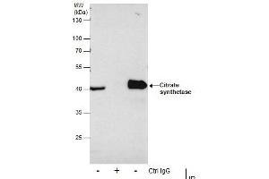IP Image Immunoprecipitation of Citrate synthetase protein from 293T whole cell extracts using 5 μg of Citrate synthetase antibody [N2C3], Western blot analysis was performed using Citrate synthetase antibody [N2C3], EasyBlot anti-Rabbit IgG  was used as a secondary reagent.