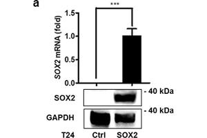 SOX2 mediates growth of bladder cancer cells. (SOX2 anticorps)