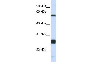 WB Suggested Anti-HABP2 Antibody Titration: 0. (HABP2 anticorps  (Middle Region))