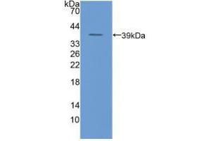 Western blot analysis of recombinant Human uPAR. (PLAUR anticorps  (AA 221-305))
