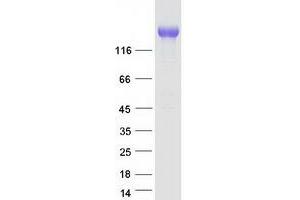 Validation with Western Blot