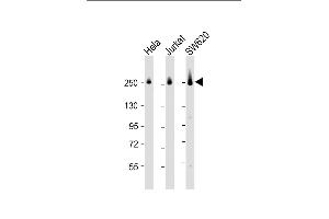 All lanes : Anti-CAD Antibody (Center) at 1:2000 dilution Lane 1: Hela whole cell lysate Lane 2: Jurkat whole cell lysate Lane 3: S whole cell lysate Lysates/proteins at 20 μg per lane.