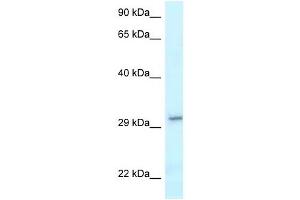 Western Blot showing VTI1B antibody used at a concentration of 1 ug/ml against NCI-H226 Cell Lysate (VTI1B anticorps  (C-Term))