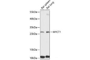Western blot analysis of extracts of various cell lines using MYCT1 Polyclonal Antibody at dilution of 1:3000. (Myc Target 1 anticorps)