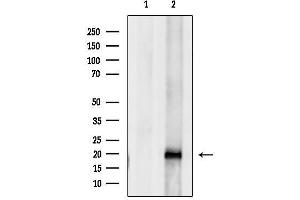 Western blot analysis of lysates from Myeloma cells, using UBE2C Antibody.