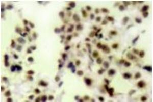 Image no. 2 for anti-Tumor Protein P73 (TP73) (pTyr99) antibody (ABIN318099) (Tumor Protein p73 anticorps  (pTyr99))