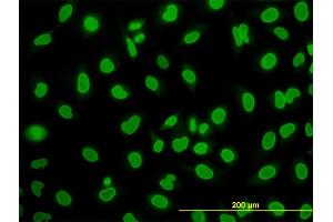 Immunofluorescence of monoclonal antibody to WDR20 on HeLa cell. (WDR20 anticorps  (AA 1-569))