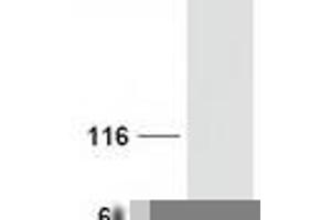 Validation with Western Blot