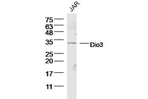 Human JAR lysates probed with Dio3 Polyclonal Antibody, Unconjugated  at 1:300 dilution and 4˚C overnight incubation.