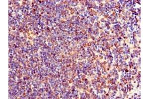 Immunohistochemistry of paraffin-embedded human lymph node tissue using ABIN7174076 at dilution of 1:100