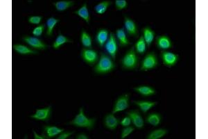 Immunofluorescence staining of A549 cells with ABIN7145462 at 1:100, counter-stained with DAPI.