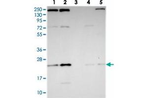 Western blot analysis of Lane 1: RT-4, Lane 2: U-251 MG, Lane 3: Human Plasma, Lane 4: Liver, Lane 5: Tonsil with THOC7 polyclonal antibody  at 1:250-1:500 dilution. (THOC7 anticorps)