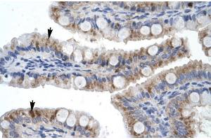 Rabbit Anti-ZNF341 Antibody Catalog Number: ARP30014 Paraffin Embedded Tissue: Human Intestine Cellular Data: Epithelial cells of intestinal villas Antibody Concentration: 4. (ZNF341 anticorps  (Middle Region))