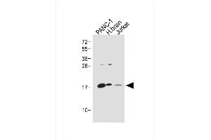 All lanes : Anti-Glucagon Antibody (C-term) at 1:1000 dilution Lane 1: NC-1 whole cell lysate Lane 2: Humanbrain lysate Lane 3: Jurkat whole cell lysate Lysates/proteins at 20 μg per lane.
