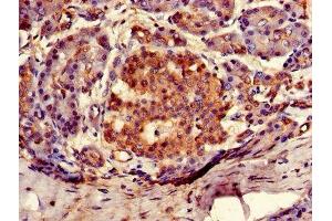 Immunohistochemistry of paraffin-embedded human pancreatic tissue using ABIN7144693 at dilution of 1:100 (ARSG anticorps  (AA 17-525))