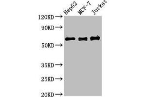 Western Blot Positive WB detected in: HepG2 whole cell lysate, MCF-7 whole cell lysate, Jurkat whole cell lysate All lanes: PRUNE1 antibody at 4 μg/mL Secondary Goat polyclonal to rabbit IgG at 1/50000 dilution Predicted band size: 51, 43, 31, 27, 25, 19 kDa Observed band size: 60 kDa (Exopolyphosphatase PRUNE1 (PRUNE1) (AA 1-168) anticorps)