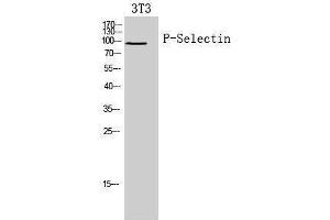Western Blotting (WB) image for anti-Selectin P (Granule Membrane Protein 140kDa, Antigen CD62) (SELP) (Internal Region) antibody (ABIN3188020)