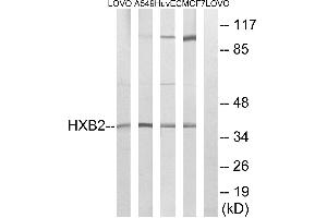 Western blot analysis of extracts from LOVO cells, A549 cells, HUVEC cells and MCF-7 cells, using HOXB2 antibody. (HOXB2 anticorps  (Internal Region))