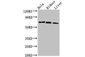 Western Blot Positive WB detected in: Hela whole cell lysate, Mouse kidney tissue, Mouse liver tissue All lanes: MLPH antibody at 3 μg/mL Secondary Goat polyclonal to rabbit IgG at 1/50000 dilution Predicted band size: 66, 63, 53, 61, 51 kDa Observed band size: 66 kDa (Melanophilin anticorps  (AA 310-539))