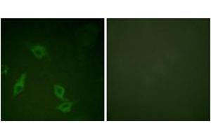 Immunofluorescence analysis of HeLa cells, using FAK (Ab-397) Antibody. (FAK anticorps  (AA 363-412))