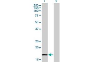 Western Blot analysis of PSCA expression in transfected 293T cell line by PSCA MaxPab polyclonal antibody. (PSCA anticorps  (AA 1-123))