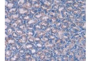 Detection of PTCH1 in Mouse Stomach Tissue using Polyclonal Antibody to Patched Homolog 1 (PTCH1)